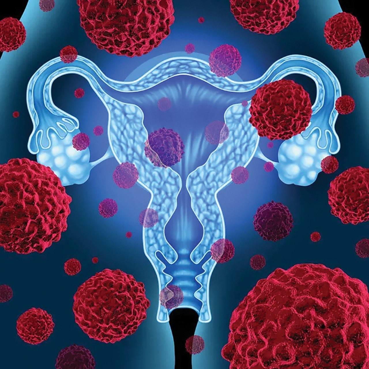 vaginal-microbiome-gynecological-cancer-1.jpg