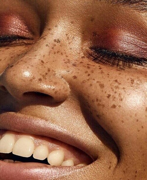 freckles3.jpg