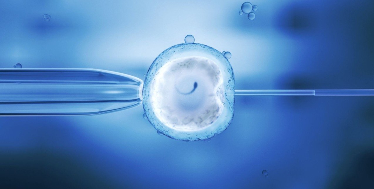 Σπερματέγχυση ή εξωσωματική γονιμοποίηση: Ποιες είναι οι διαφορές;