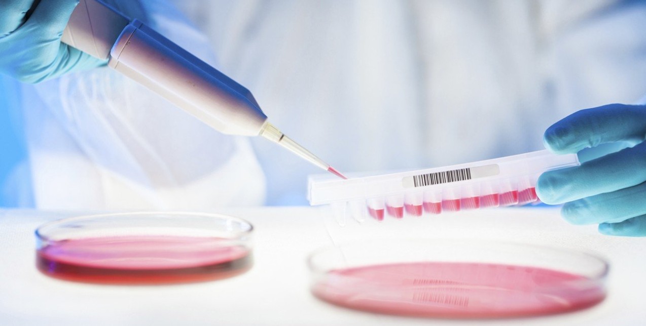 Ένα βήμα πιο κοντά στο πρώτο τεστ αίματος που θα ανιχνεύει 8 είδη καρκίνου 