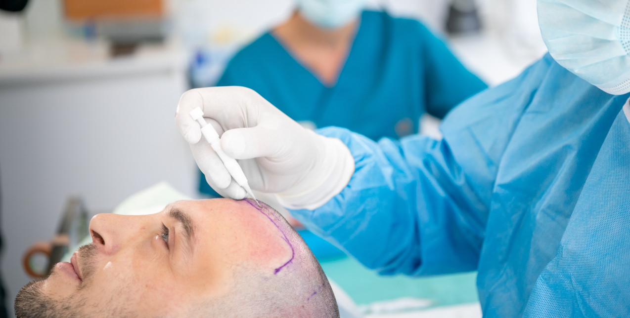 Η κλινική μεταμόσχευσης μαλλιών στην καρδιά της Θεσσαλονίκης που εφαρμόζει μια από τις πλέον καινοτόμες τεχνικές παγκοσμίως