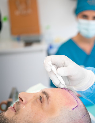 Η κλινική μεταμόσχευσης μαλλιών στην καρδιά της Θεσσαλονίκης που εφαρμόζει μια από τις πλέον καινοτόμες τεχνικές παγκοσμίως