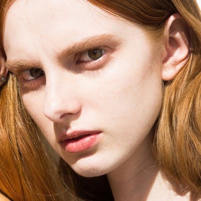 Skin Peels: Όσα πρέπει να γνωρίζετε για το πήλινγκ και τα οξέα προσώπου 